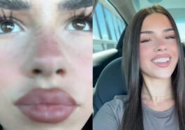 La vidéo qui a cassé l'algorithme: personne ne comprend pourquoi elle a des millions de vues 55 Image