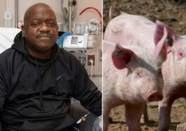 Richard Slayman, 62 ans, est le premier homme à avoir reçu une greffe d'un rein de porc génétiquement modifié / Crédit : MGH