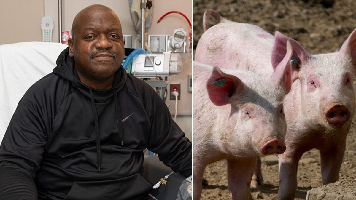 Le premier homme avec un rein de porc transplanté a été autorisé à quitter l'hôpital 2 Richard Slayman, 62 ans, est le premier homme à avoir reçu une greffe d'un rein de porc génétiquement modifié / Crédit : MGH