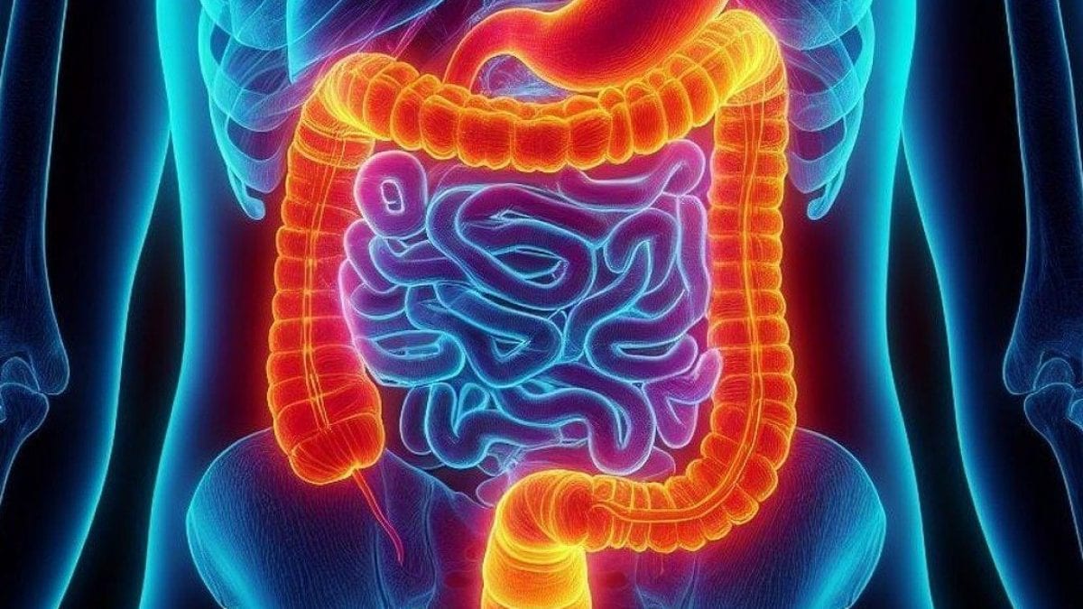 Cancer du côlon, un traitement qui vise des thérapies ciblées : que dit l'étude sur la biopsie liquide 2 Immagine