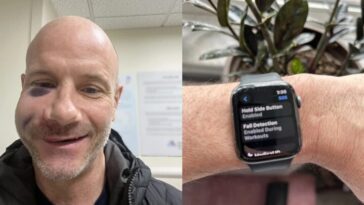 Un cycliste pris dans une tempête subit un accident et est « sauvé » par la détection de chute de l'Apple Watch 28 Un cycliste pris dans une tempête subit un accident et est « sauvé » par la détection de chute de l'Apple Watch