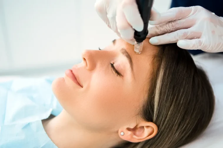 Des cas de transmission du VIH après des "vampire facial" inquiètent le CDC 1 Vampire Facial