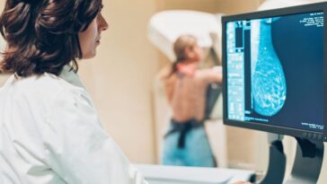 Cancer du sein : un mécanisme dévoilé qui rend la forme la plus courante résistante, des espoirs pour un traitement 5 Immagine