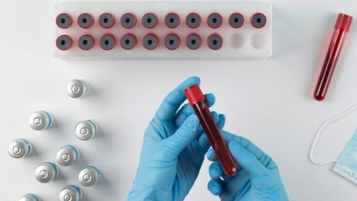 Ces plaquettes synthétiques pourraient remplacer les humaines: elles parviennent à arrêter une hémorragie 2 Immagine