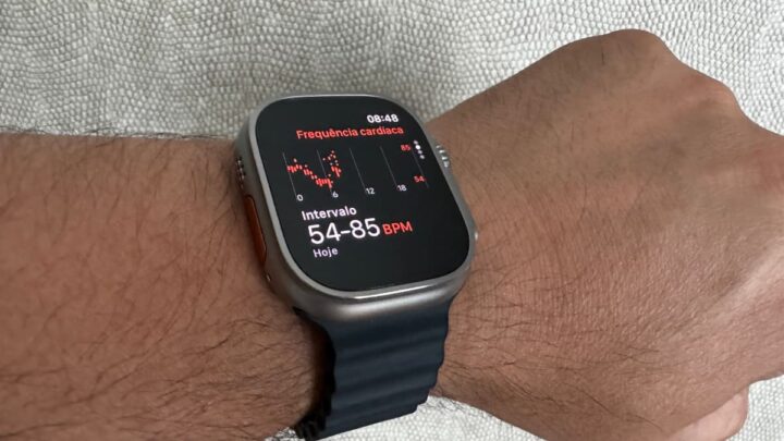 L'Apple Watch est important pour les personnes soumises à des chirurgies valvulaires cardiaques 2 Image de l'Apple Watch