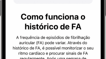 La fonction de fibrillation auriculaire de l'Apple Watch reçoit une nouvelle approbation de la FDA 10 Un iPhone affichant l’écran de configuration Comment fonctionne FA History