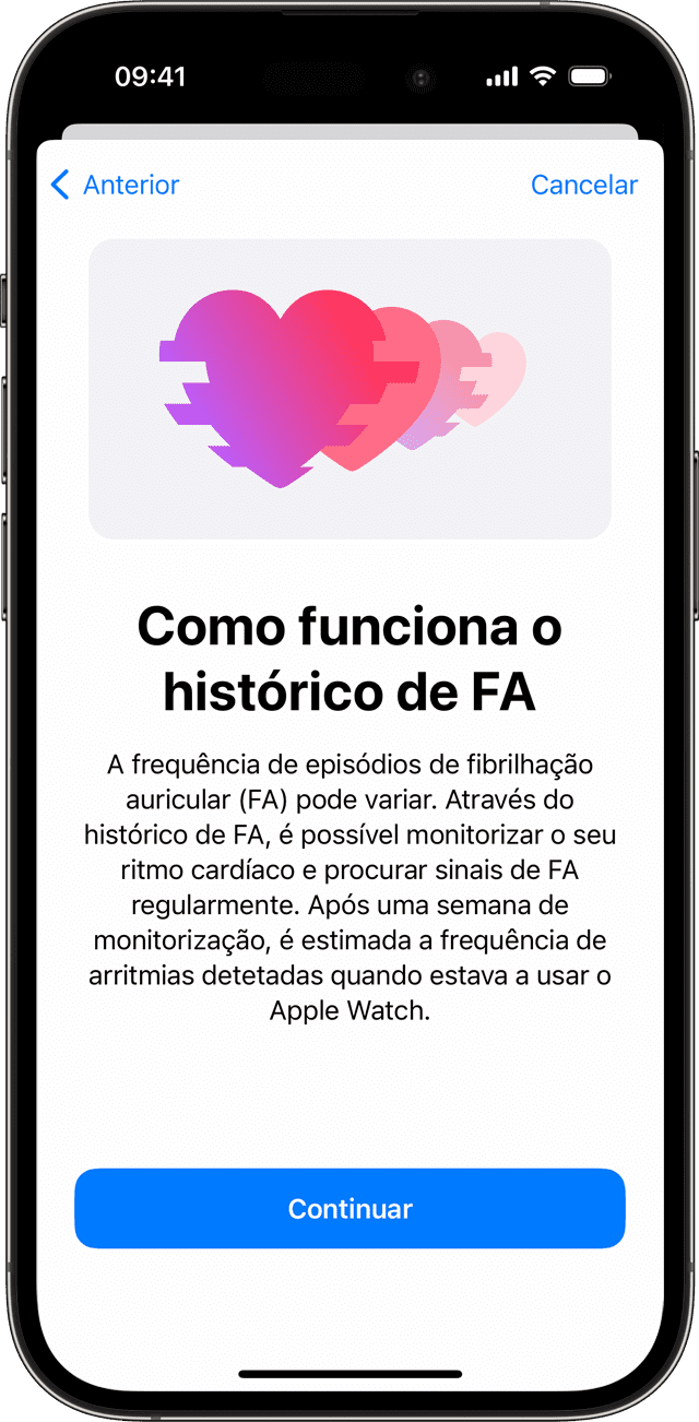 La fonction de fibrillation auriculaire de l'Apple Watch reçoit une nouvelle approbation de la FDA 2 Un iPhone affichant l’écran de configuration Comment fonctionne FA History