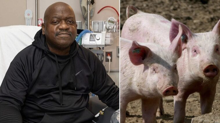 Le premier bénéficiaire du rein de porc génétiquement modifié est décédé deux mois après l'intervention 1 Image