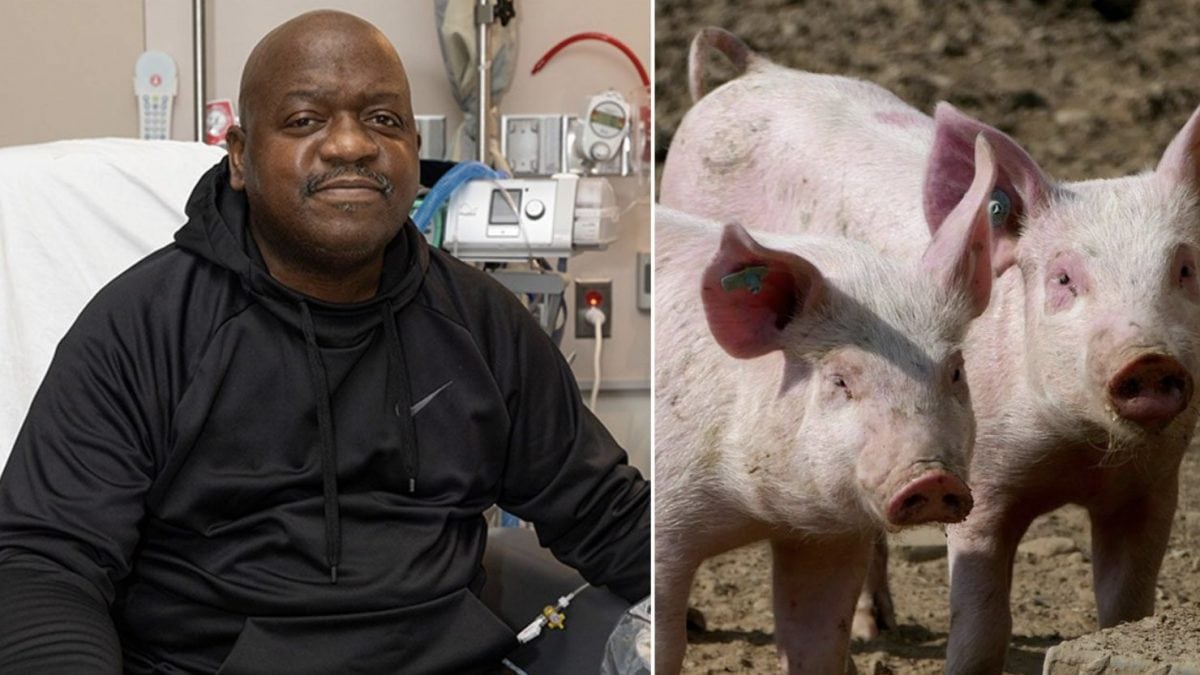 Le premier bénéficiaire du rein de porc génétiquement modifié est décédé deux mois après l'intervention 2 Image