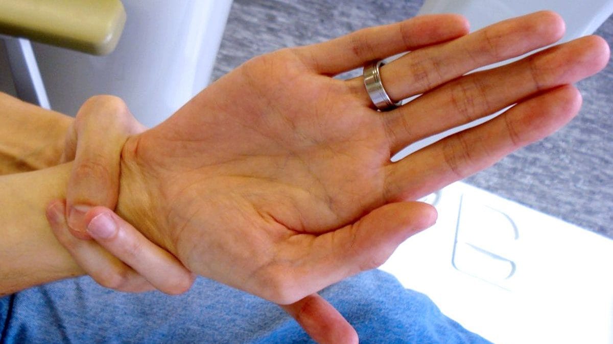Qu'est-ce que le syndrome de Marfan, symptômes de la maladie génétique et comment est posé le diagnostic 2 Uno dei segni della sindrome di Marfan è legato alla lunghezza delle dita: il pollice e il mignolo della mano che afferra il polso si sovrappongono / Credit: Staufenbiel I, et al. Wikipedia