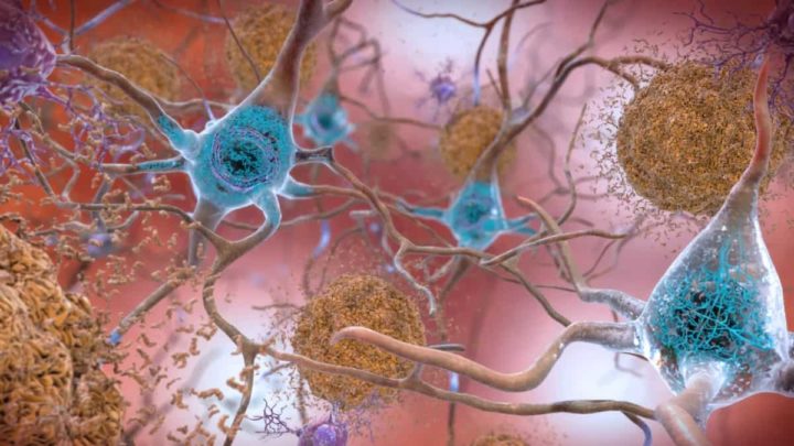 La pollution de l'air favorise-t-elle la maladie d'Alzheimer et d'autres troubles cérébraux ? 3 Cerveau