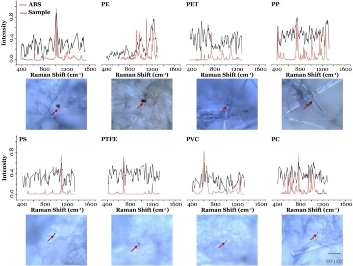 Expérience révèle des microplastiques dans les échantillons de sperme humain testés 4 1718472190 829 Experience revele des microplastiques dans les echantillons de sperme humain