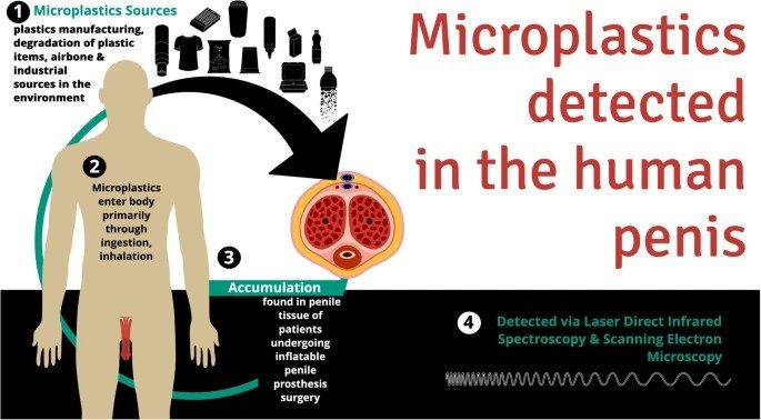 Le pénis aussi envahi par les microplastiques : retrouvé dans 4 échantillons sur 5, risque de dysfonction érectile 3 Crédit: International Journal of Impotence Research (IJIR)