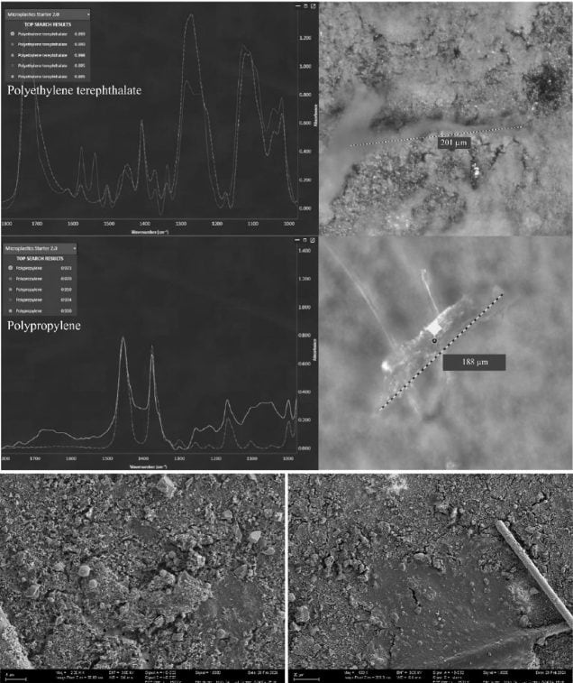 Le pénis aussi envahi par les microplastiques : retrouvé dans 4 échantillons sur 5, risque de dysfonction érectile 4 Crédit: International Journal of Impotence Research (IJIR)