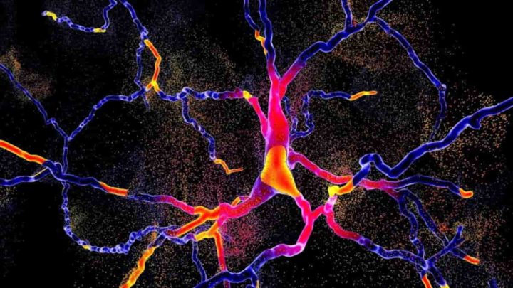 La maladie de Parkinson : bien plus qu'une simple perturbation du mouvement, elle impacte tout un réseau cérébral ! 2 Parkinson