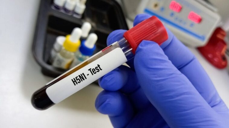 Cas de grippe aviaire H5N1 chez une fillette de deux ans, le premier cas enregistré en Australie 1 Immagine