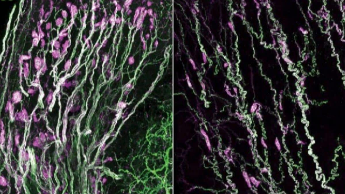 Ce qui rend le clitoris et le pénis si sensibles: une étude a découvert ce qui active le plaisir 2 NATURE | Image de l