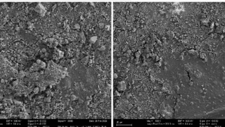 Le pénis aussi envahi par les microplastiques : retrouvé dans 4 échantillons sur 5, risque de dysfonction érectile 1 Microplastiques trouvés dans le tissu pénien. Crédit: International Journal of Impotence Research (IJIR)