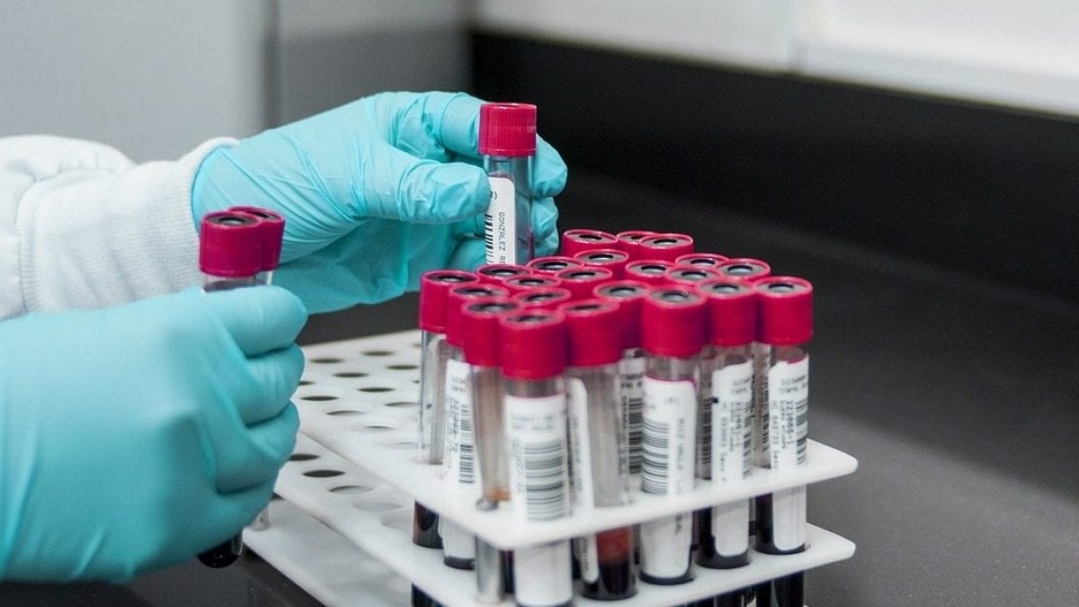Un test sanguin innovant détecte la SLA : « Il est crucial d'améliorer la vitesse de diagnostic » 2 Image