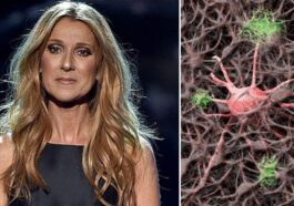 Céline Dion, la chanteuse canadienne souffre du syndrome de la personne raide, une maladie neurologique rare et progressive d'origine auto-immune qui provoque des symptômes tels que raideur musculaire et spasmes douloureux.