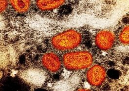 Particelle del virus del vaiolo delle scimmie (mpox) all'interno di una cellula infetta / Credit: NIAID