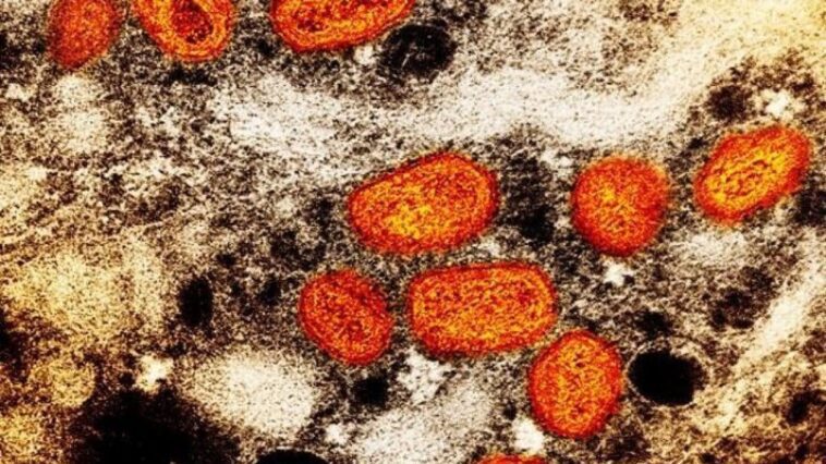 Variole des singes, que savons-nous de la nouvelle souche de monkeypox "C'est le plus dangereux de tous" 1 Particelle del virus del vaiolo delle scimmie (mpox) all'interno di una cellula infetta / Credit: NIAID