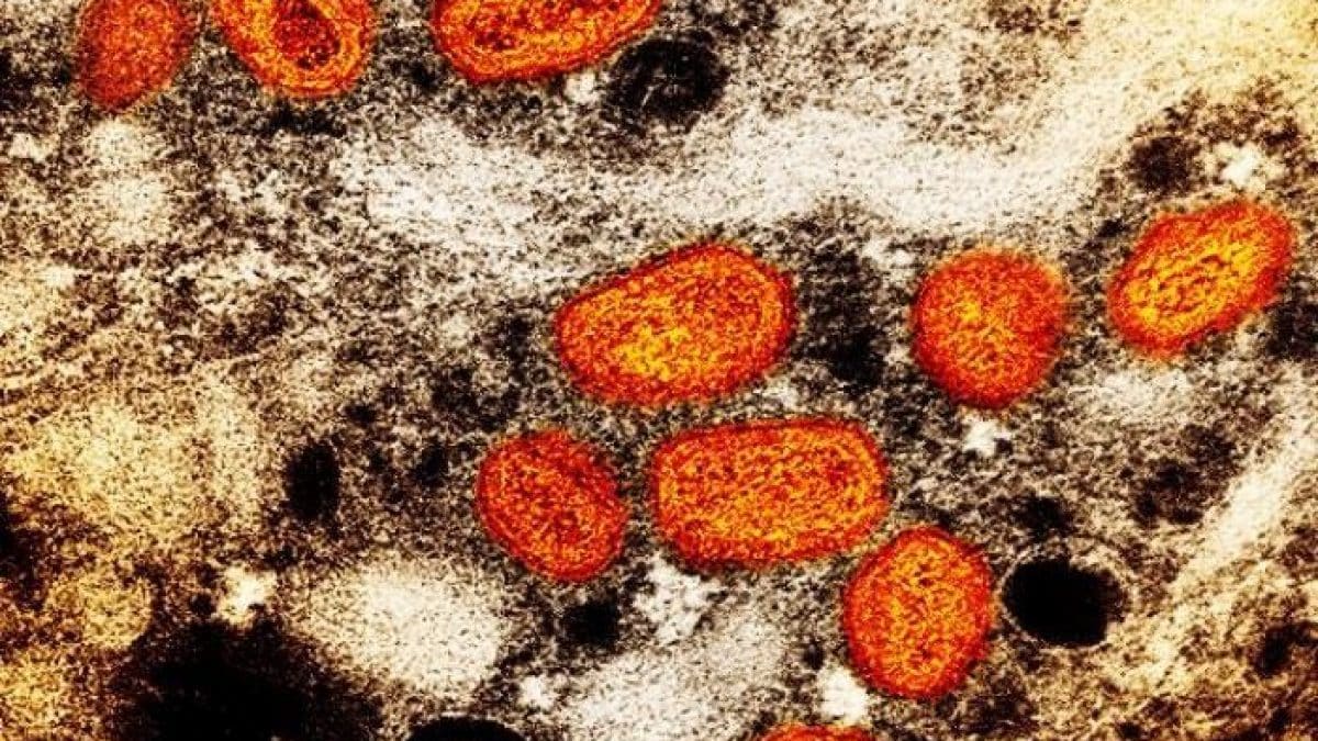 Variole des singes, que savons-nous de la nouvelle souche de monkeypox "C'est le plus dangereux de tous" 2 Particelle del virus del vaiolo delle scimmie (mpox) all'interno di una cellula infetta / Credit: NIAID