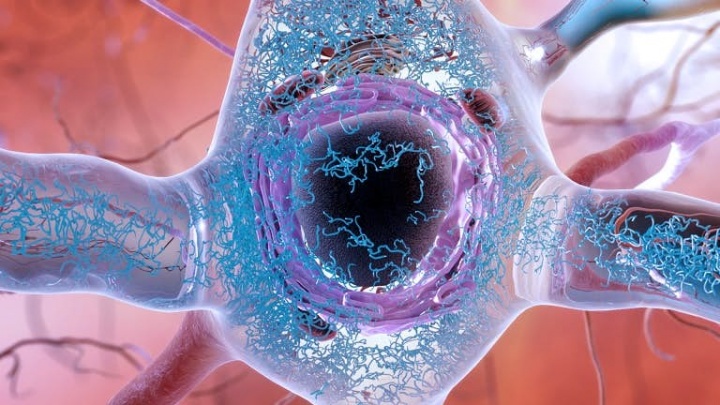 Le Royaume-Unis approuve un médicament qui peut retarder les symptômes de la maladie d'Alzheimer 3 1720360693 988 Le risque de maladie dAlzheimer est fortement influence par le