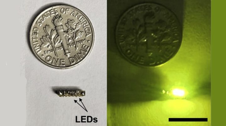 Implants minuscules combattent le cancer avec la lumière 3 1720897069 521 Implants minuscules combattent le cancer avec la lumiere