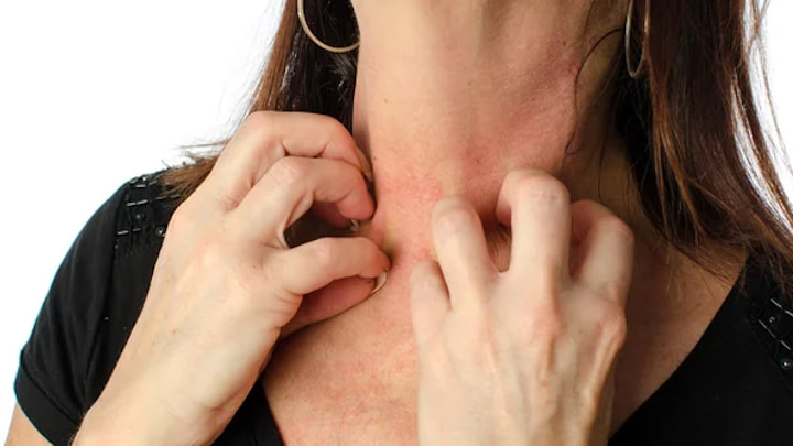 Pourquoi se gratter réduit les démangeaisons de la peau ? Devriez-vous le faire ? 3 1720970989 417 Pourquoi se gratter reduit les demangeaisons de la peau