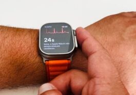 Image de l'Apple Watch avec ECG