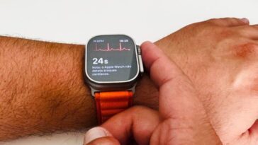 Apple Watch peut détecter la principale cause des crises cardiaques, indique ce médecin 30 Image de l'Apple Watch avec ECG