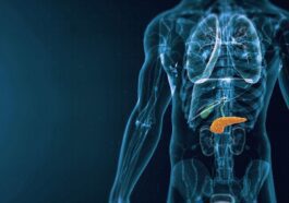 Le cancer du pancréas est une néoplasie qui touche les cellules pancréatiques/Crédit : iStock