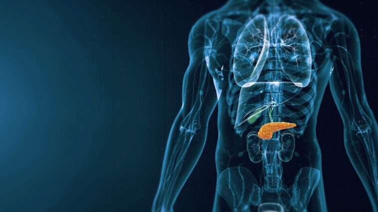Cancer du pancréas : découverte inédite sur l'accélération de la maladie 1 Le cancer du pancréas est une néoplasie qui touche les cellules pancréatiques/Crédit : iStock