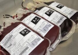 Em determinadas circunstâncias raras, o seu tipo de sangue pode mudar