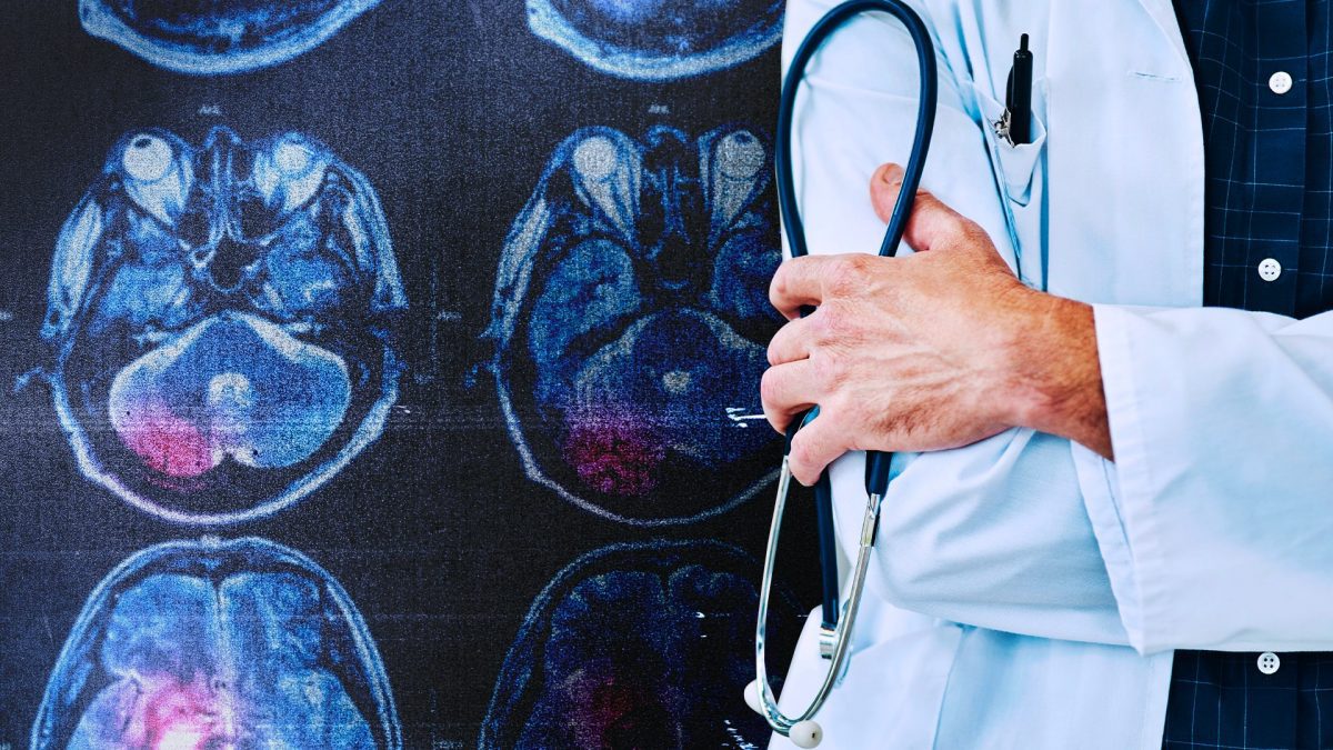 J'ai eu des cas d'Alzheimer dans ma famille. J'ai passé tous les tests pour comprendre mon risque 2 Immagine
