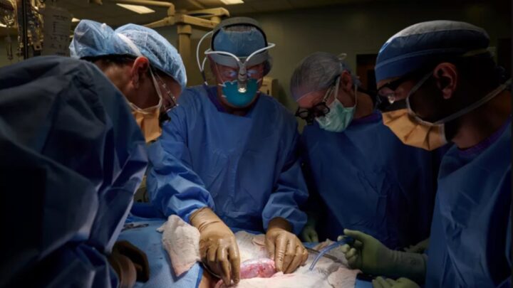 La deuxième personne à recevoir une greffe de rein de porc est décédée 3 La deuxieme personne a recevoir une greffe de rein de