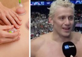 Les doutes sur la technique utilisée par les nageurs aux JO : "Nous n'avons pas de preuves sur les effets du cupping" 78 Image