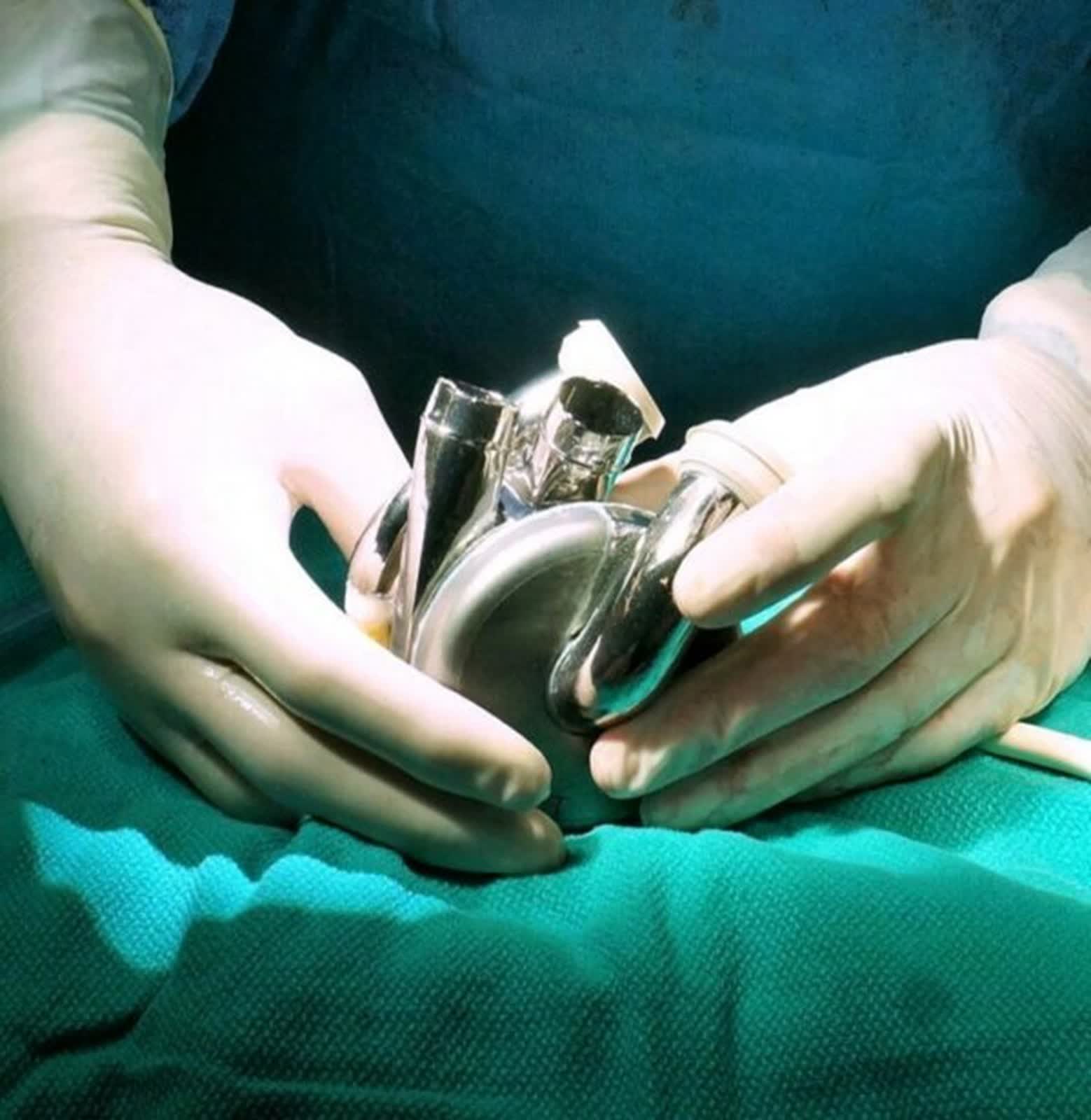 Un cœur rotatif en titane maintient le patient en vie pendant 8 jours jusqu'à la transplantation 2 Un coeur rotatif en titane maintient le patient en vie
