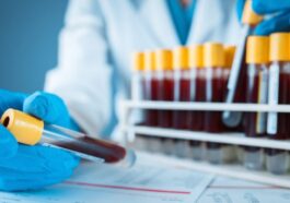 Un simple et nouveau test sanguin peut détecter Alzheimer avec une précision de 90% / Photo Crédit : iStock