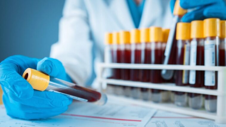 Un examen de sang pour l'Alzheimer identifie la perte de mémoire avec une précision de 90% 1 Un simple et nouveau test sanguin peut détecter Alzheimer avec une précision de 90% / Photo Crédit : iStock