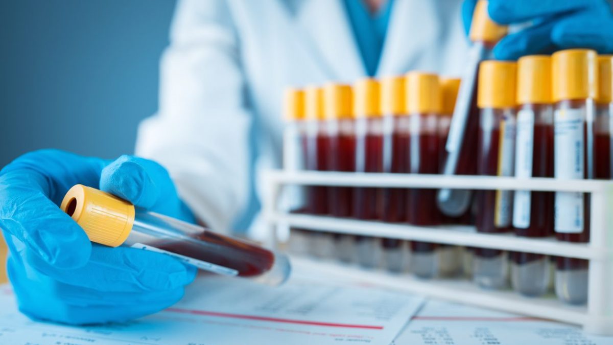 Un examen de sang pour l'Alzheimer identifie la perte de mémoire avec une précision de 90% 2 Un simple et nouveau test sanguin peut détecter Alzheimer avec une précision de 90%