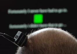 UC Davis researchers debut highly accurate brain-to-speech technology