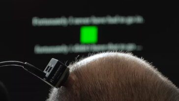 Des chercheurs de l'Université de Californie à Davis lancent une technologie de synthèse vocale extrêmement précise 10 UC Davis researchers debut highly accurate brain-to-speech technology