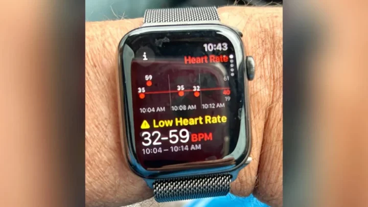 Un ancien dirigeant de Microsoft évoque que l'Apple Watch lui a sauvé la vie 4 1724672650 322 Un ancien dirigeant de Microsoft evoque que lApple Watch lui.webp
