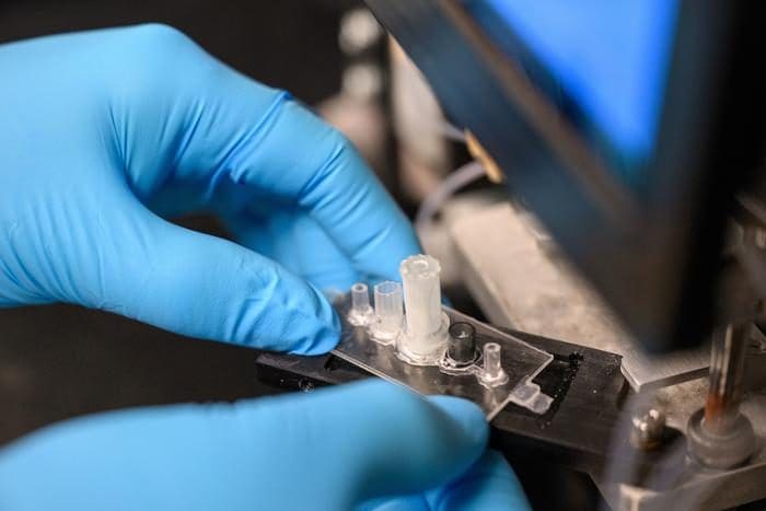 Cancer au cerveau, un test sanguin innovant détecte le létal glioblastome en moins d'une heure 3 Le biochip qui permet de détecter le glioblastome à partir du sang. Crédit : Matt Cashore/University of Notre Dame