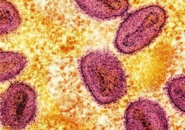 Particules de virus de la variole simienne (en rose) à l'intérieur d'une cellule infectée (en jaune) / Crédit : NIAID