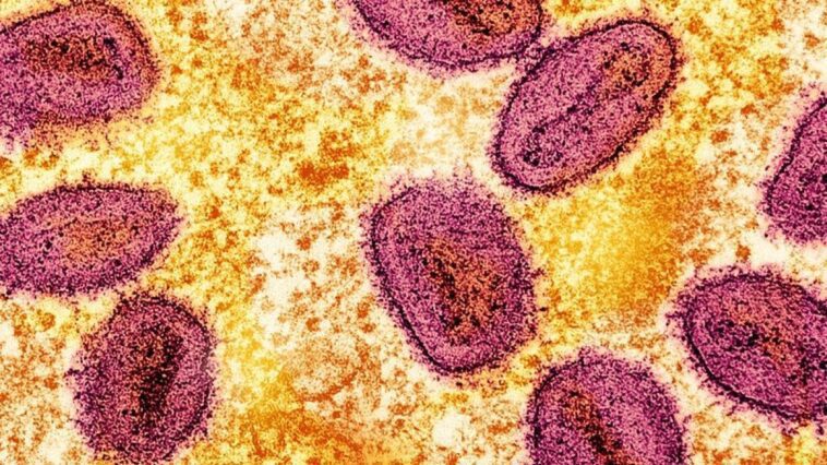 Mpox, virus de la variole simienne : l'OMS tire la sonnette d'alarme : "Augmentation continue des cas" 1 Particules de virus de la variole simienne (en rose) à l'intérieur d'une cellule infectée (en jaune) / Crédit : NIAID
