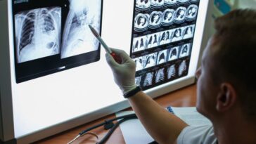 Que savons-nous de BNT116, le premier vaccin à mRNA contre le cancer du poumon actuellement en expérimentation au Royaume-Unis 2 Image