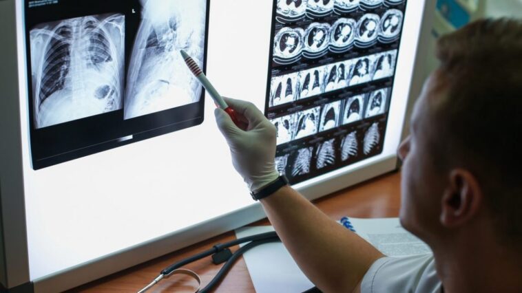Que savons-nous de BNT116, le premier vaccin à mRNA contre le cancer du poumon actuellement en expérimentation au Royaume-Unis 1 Image